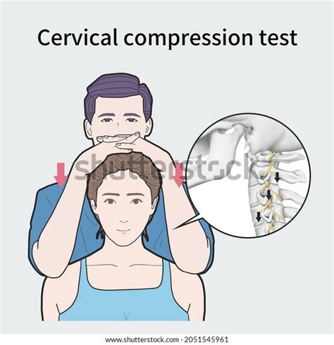 lateral cervical compression test|shoulder depression test positive.